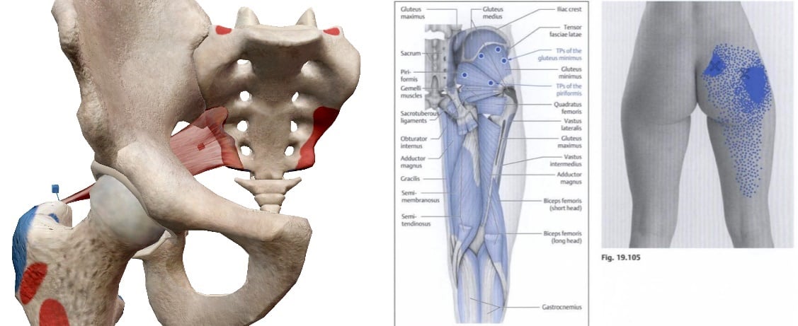 Priformis