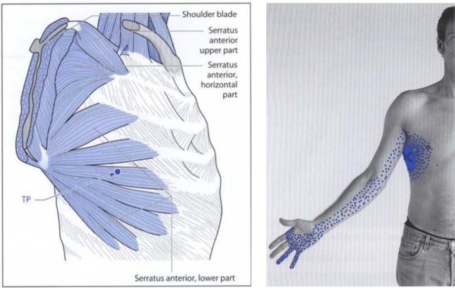 Serratus Anterior